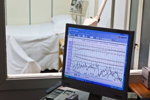 Neurofisiología